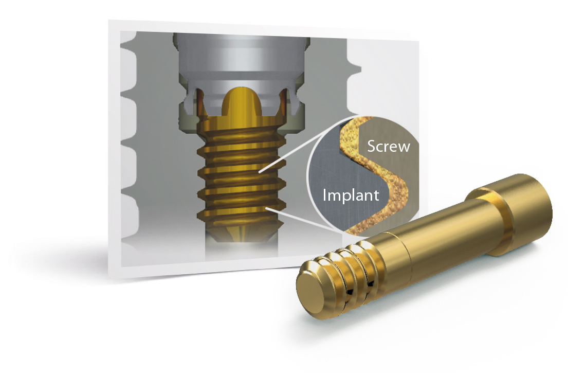 sureseal technology implants